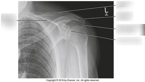 DIAGRAM - Apical AP Axial Shoulder Anatomy(Xray) - 2018 Diagram | Quizlet