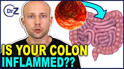 Colon Inflammation - The Symptoms, Dangerous Side Effects, and How To ...