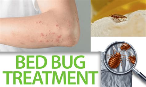 Bed Bug Treatment - Brooklyn