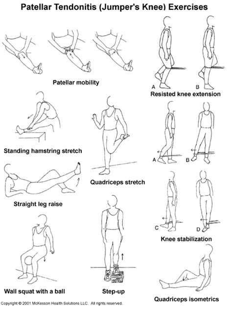 Sports Medicine Advisor 2003.1: Patellar Tendonitis (Jumper's Knee ...