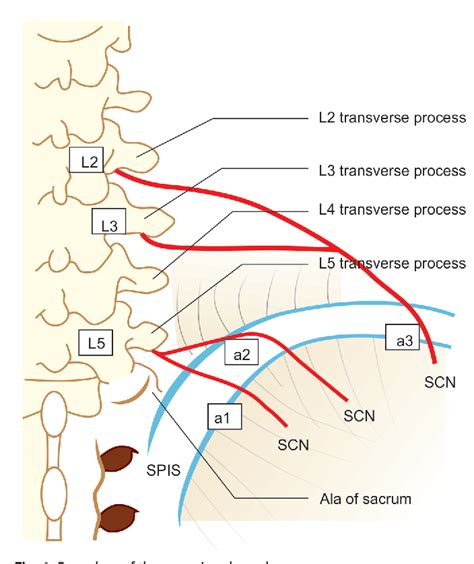 Figure 1 from Superior Cluneal Nerve Entrapment—Possible Pain Generator in Low Back Pain ...