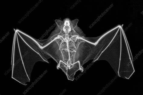 Common pipistrelle bat, X-ray - Stock Image - C057/2877 - Science Photo Library