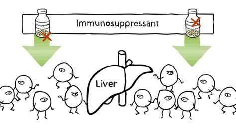 Taking immunosuppressants after your organ transplant - YouTube