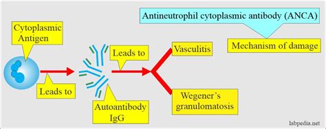 Antineutrophil cytoplasmic antibody (ANCA), Wegener's Granulomatosis ...