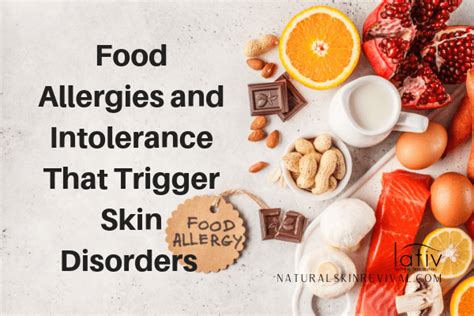 8 Food Allergies & Intolerance That Cause Skin Disorders - Natural Skin ...