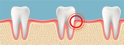 Gum Pain Causes, Relief, and Treatments - Crest
