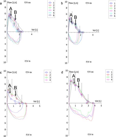 Representative examples of the SP sign in BPTs and BDTs. a SP sign in... | Download Scientific ...