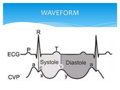 Central venous pressure