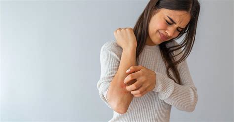 TrustCare | The Most Common Types of Skin Rashes & Treatment