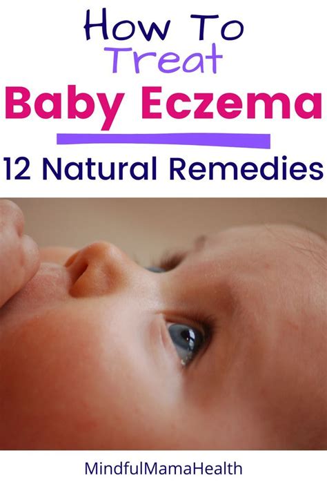 Safe and Effective Baby Eczema Natural Remedies - Mindful Mama Health | Baby eczema treatment ...