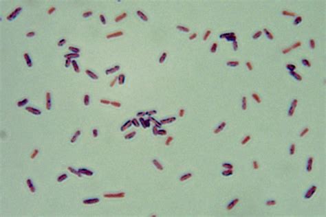 Clostridium Perfringens Gram Stain