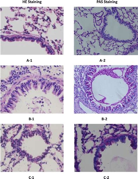 HE staining and PAS staining results of the lung tissue (×200). The... | Download Scientific Diagram