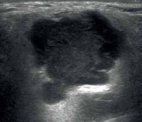 Standards for the assessment of salivary glands – an update in 2021 | Salivary gland, Ultrasound ...