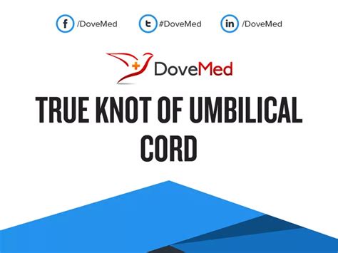 True Knot of Umbilical Cord - DoveMed