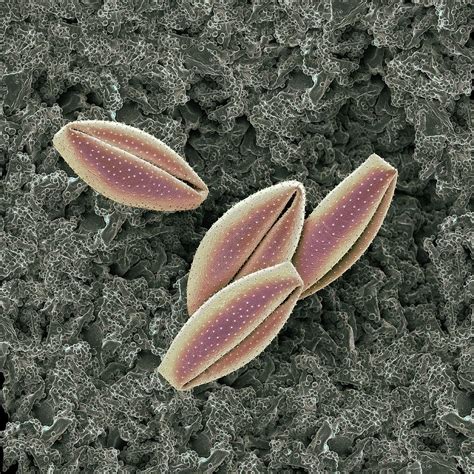 Lily Pollen Grains Photograph by Martin Oeggerli/science Photo Library ...