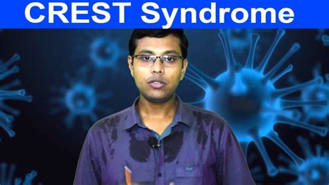 CREST syndrome | definition, causes, pathology, symptoms, diagnosis, treatment - YouTube