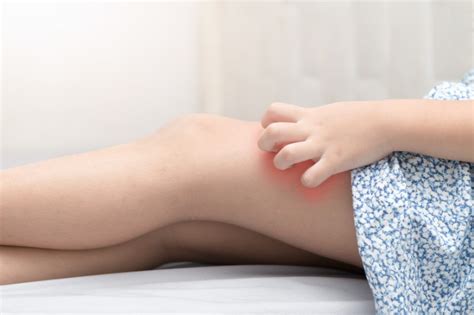 The Causes, Symptoms and Risk Factors of Cellulitis + PlusVitality