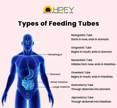 Enteral Feeding: What, When, and How | Read at HPFY