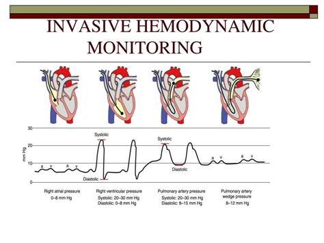 PPT - INVASIVE HEMODYNAMIC MONITORING PowerPoint Presentation, free download - ID:6333249