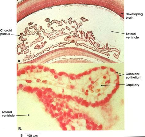 Choroid Plexus Histology