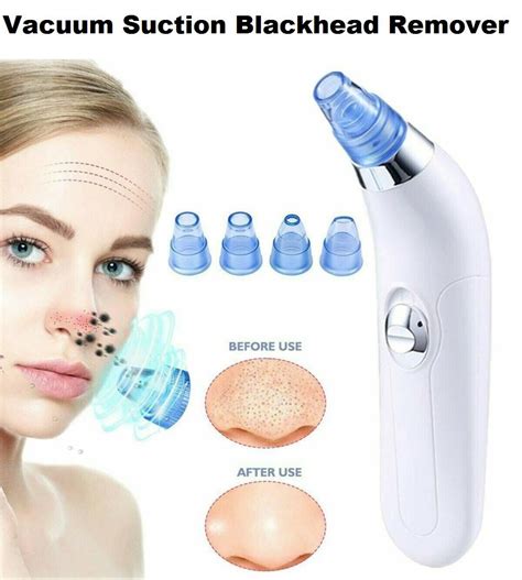 Kamaly Vacuum Suction Blackhead Remover Nose Facial Pore Cleaner ...