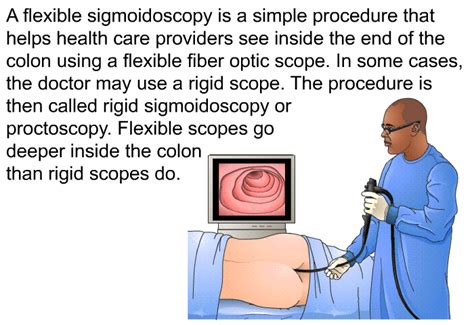 PatEdu.com : Sigmoidoscopy