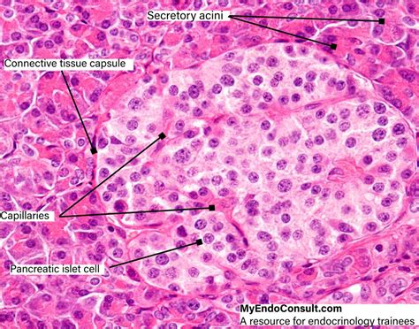 Islet Cells Of The Pancreas - MyEndoConsult