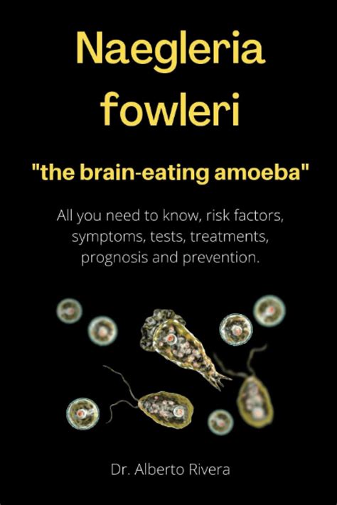 Naegleria fowleri, the brain-eating amoeba.: All you need to know, risk factors, symptoms ...