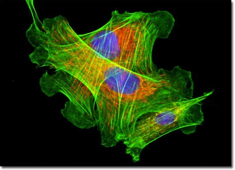 The Biology Lair — Fibroblasts are connective tissue cells...