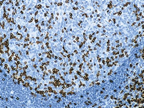 CD3 T-Cell Antibody- Biocare Medical