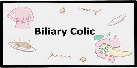 Biliary Colic - Assignment Point