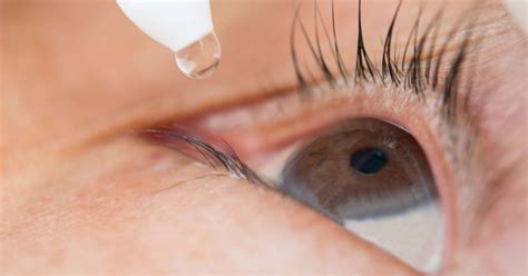 Blepharitis: Treatment, symptoms, pictures, and causes