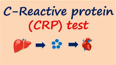 What Does Low Protein C Mean at Ronald Popovich blog