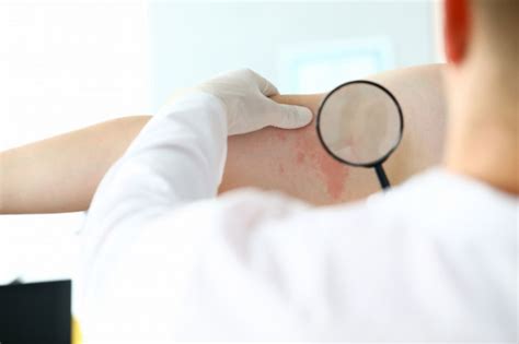 5 Skin Cancer Treatment Options In The Philippines