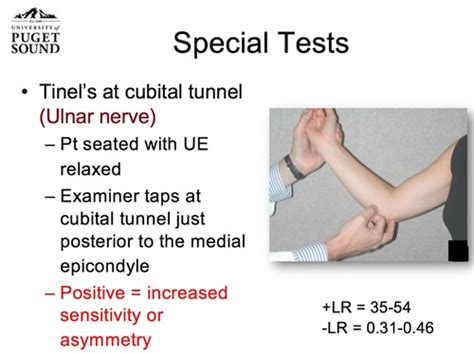 Ulnar vs. median nerve tests Flashcards | Quizlet