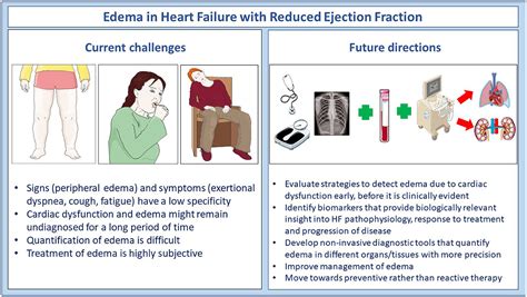 From Heart Failure Pulmonary Edema