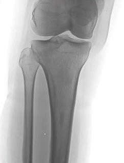 Bone Island - Sumer's Radiology Blog