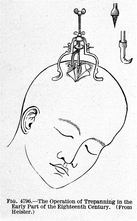 The Beginnings of Medical Technology – Technology: Where it Started and ...