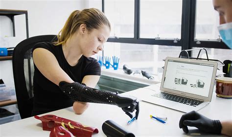 Amputee Prosthetic Arm