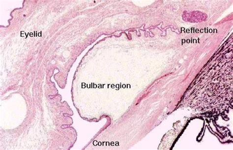 Bulbar Conjunctiva Histology