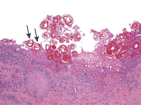 Head and Neck Pathology | Ento Key