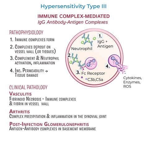 Clinical Pathology Glossary: Hypersensitivity Type III | ditki medical ...