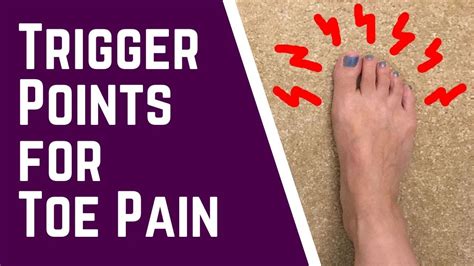 Trigger Points for Toe Pain - Massage Monday #469 - YouTube