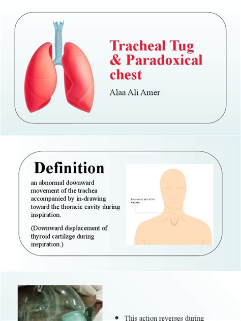 Tracheal Tug - Paradoxical Chest Movement | PDF