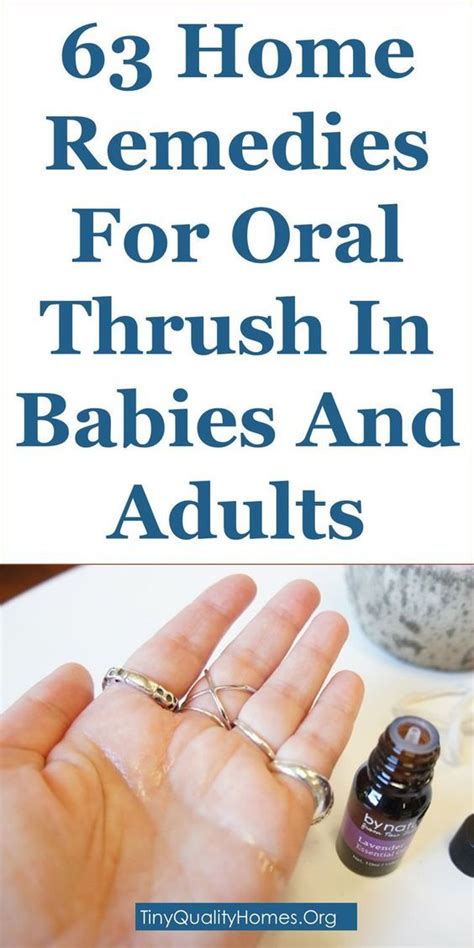 63 Home Remedies For Oral Thrush In Babies And Adults (With images ...