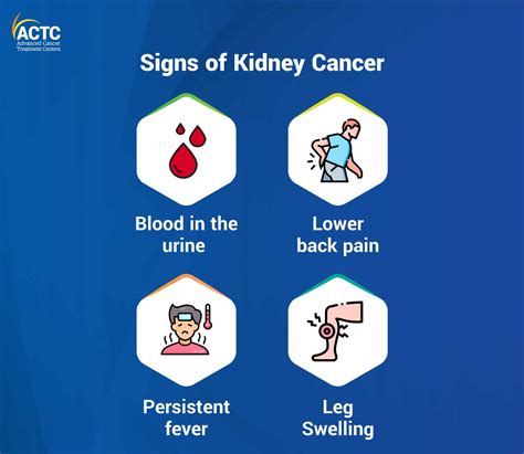 Be Aware of These Warning Signs of Kidney Cancer | ACTC