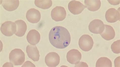 Malaria Intracellular parasite. Plasmodium is a single celled protozoan carried by mosquitoes ...