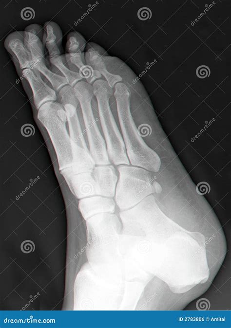 Right Foot Bones