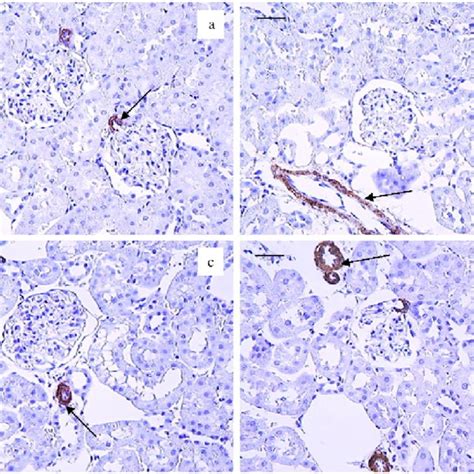 Immunohistochemical staining for 〈alpha〉-Smooth muscle actin in control ...