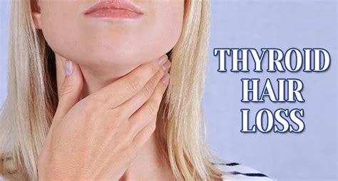 The Fundamentals Of Thyroid Hair Loss Revealed - Lewigs